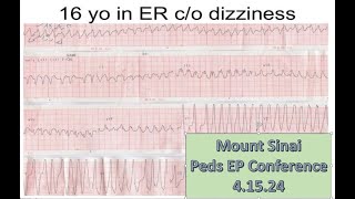 Mount Sinai Pediatric EP Conference 41524 [upl. by Smail556]