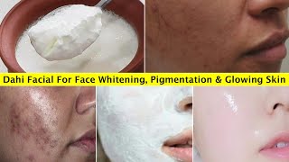 1 Time Skin Whitening Dahi Facial👆that removes Pigmentation amp Dark Spots Brightens Dull Dark Skin [upl. by Ecnarepmet]