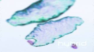 Macrophages engulfing pathogens Hybrid Medical Animation HD [upl. by Ahsiekin724]