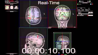 fMRI analysis in 15 seconds [upl. by Nace]