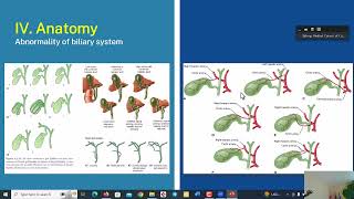 ACUTE CHOLECYSTITIS DR LAY SOURKEIR [upl. by Elwin]