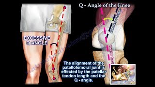 Q Angle Of The Knee  Everything You Need To Know  Dr Nabil Ebraheim [upl. by Aivizt]