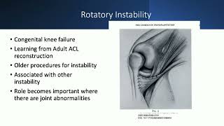 Hypoplasia of femoral condyle approach amp management  N Nicolaou [upl. by Blim]