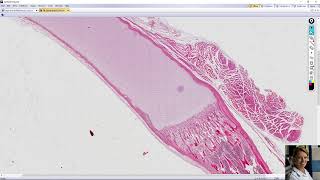 endochondral ossification [upl. by Girish358]