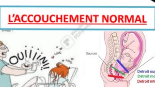 accouchement normal  part 5 [upl. by Joannes]