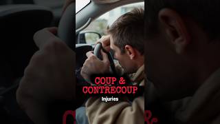 Coup and Contrecoup Head Injury shorts youtubeshorts [upl. by Repsihw]