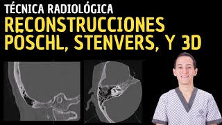 Tutorial Tomografía Computarizada Oído Reconstrucciones Pöschl Stenvers y 3D [upl. by Llehsim627]