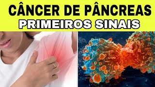 7 Sinais Iniciais de CÂNCER de PÂNCREAS Sintomas de Insulinoma [upl. by Etteoj874]