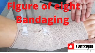 Figure of Eight Bandaging by PC nursing procedure [upl. by Ecirpak]