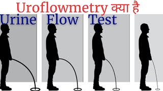 Uroflowmetry test in Hindi  urine flow test explained  Uroflowmetry test kaise hota hai [upl. by Eidderf]