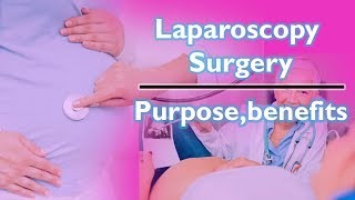 Laparoscopy Surgery  Purpose  Benefits [upl. by Murtha348]