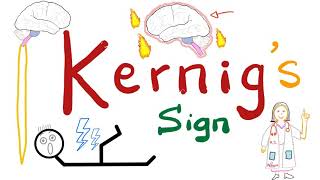 Kernig Sign  Meningitis  Neurology Physical Exam [upl. by Levona]