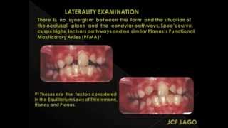 ORTHODONTIC TREATMENT IN THE MIXED DENTITION [upl. by Hawger]