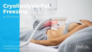 Cryolipolysis Fat Freezing [upl. by Denis]