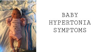 Baby Hypertonia Symptoms [upl. by Wayne]