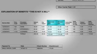 Explanation of Benefits EOB [upl. by Mir848]