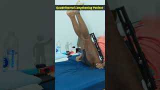 physiotherapy  Quadrilateral Lengthening Patient  Height increase Surgery Limb lengthening Surgery [upl. by Llehsim]