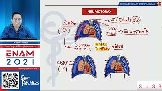 Neumotórax simple abierta y a tensión  Qx medic neumerology [upl. by Gnok332]