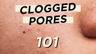 🤭Everything you need to know about CLOGGED PORES • Skincare amp makeup products are not the culprit [upl. by Isolt]