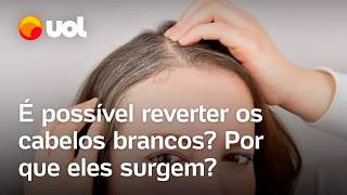 Cabelo branco é possível reverter Estresse sono irregular e má alimentação influenciam confira [upl. by Anatol718]