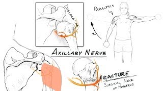 The Brachial Plexus II Animated Review HD [upl. by Uht]