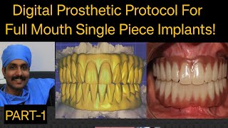 Digital workflow for full mouth prosthesis with single piece dental implantsDrMurugavel discussion [upl. by Alrrats]