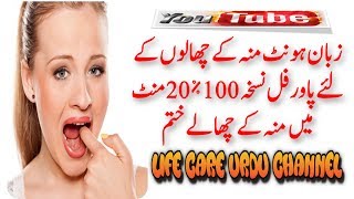 Mouth Blisters Treatment In Urdu   Blister In Mouth Treatment  Muh Ke Chalo Ka Ilaj [upl. by Echo]