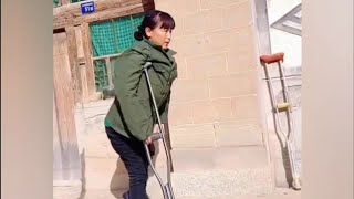 The beautiful woman with polio goes out to work on crutches disability [upl. by Ehsiom]