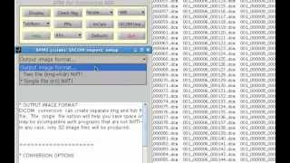 SPM Tutorial 2 Dicom Import [upl. by Trojan]