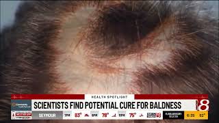 Scientists find potential cure for baldness [upl. by Thatcher]