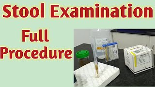 Stool examination  Stool microscopic examination  Stool examination in hindi Stool test procedure [upl. by Zerla]