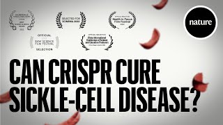 Can CRISPR cure Sicklecell Disease [upl. by Esinev364]