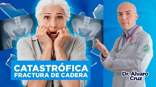 Lo que NADIE TE CUENTA🤫 sobre la CATASTRÓFICA FRACTURA de CADERA😨💔 [upl. by Nahsrad534]