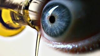 Does Castor Oil Help with Cataracts [upl. by Ellenrahs]