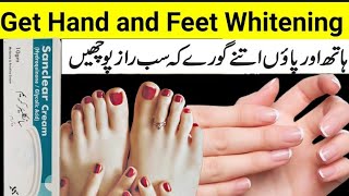 Sanclear Cream Review l Sanclear Cream for hand and feet Whitening [upl. by Ettezyl]