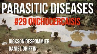 Parasitic Diseases Lectures 29 Onchocercaiasis [upl. by Zea17]