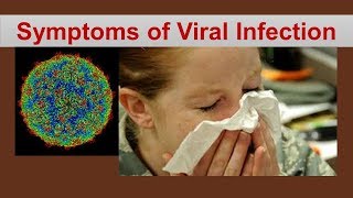 Common symptoms of Viral Infection [upl. by Rehoptsirhc]