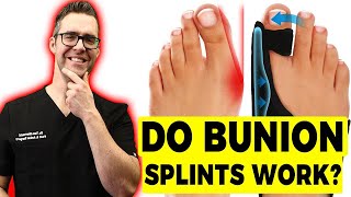 Do Bunion Correctors Work How To SHRINK Bunions Naturally [upl. by Eylrahc]