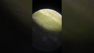 Spirogyra under microscope youtubeshorts viralvideo viralshorts recommended [upl. by Enirrok405]