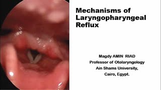 Mechanisms of Laryngopharyngeal Reflux [upl. by Chuipek]