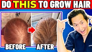 How to Treat Thinning Hair The Holistic Way [upl. by Artinek]