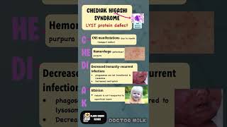 Chediak higashi mnemonic neetpg usmle pediatrics [upl. by Cailean]