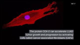 COX2 promotes lung adenocarcinoma progression via exosomal miR1290 [upl. by Indihar]