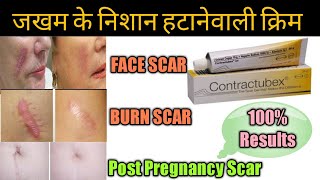 Contractubex Gel review पुराने से पुराने scars Marks को जड़ से मिटा देता है ये जेल।। [upl. by Ybab]