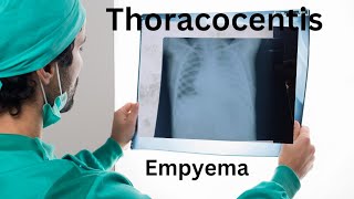 lung empyema empyema lungs effusion puslungdiseases respiratorydiseases thoracocentisis [upl. by Placeeda]