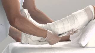 Plaster of Paris Lower Leg Splint Application [upl. by Toomin697]