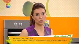 Cildimde siyah lekeler ve sivilceler var ne yapmalıyım [upl. by Duster]