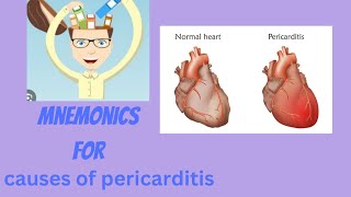 MNEMONICS for causes of pericarditis [upl. by Ezarras]