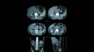 RADIOLOGY EXAM CASES [upl. by Bowra]