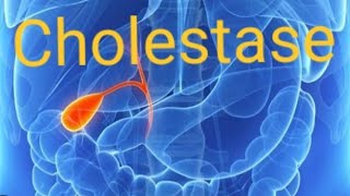 SYNDROME DE CHOLESTASE  DIAGNOSTIC ET ETIOLOGIES [upl. by Ainehta10]